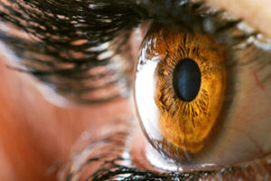 Close-up of an eye after LASIK