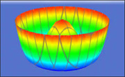 Wavefront-Guided LASIK Eye Surgery Diagram